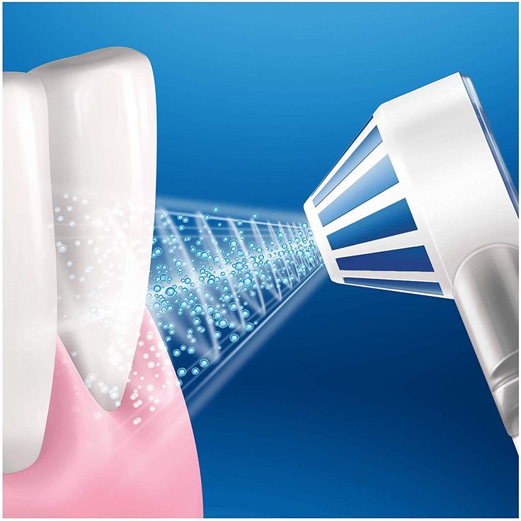 Oral-B AquaCare 4 Kabellose Munddusche mit Oxyjet-Technologie, für gesünderes Zahnfleisch – Bild 3