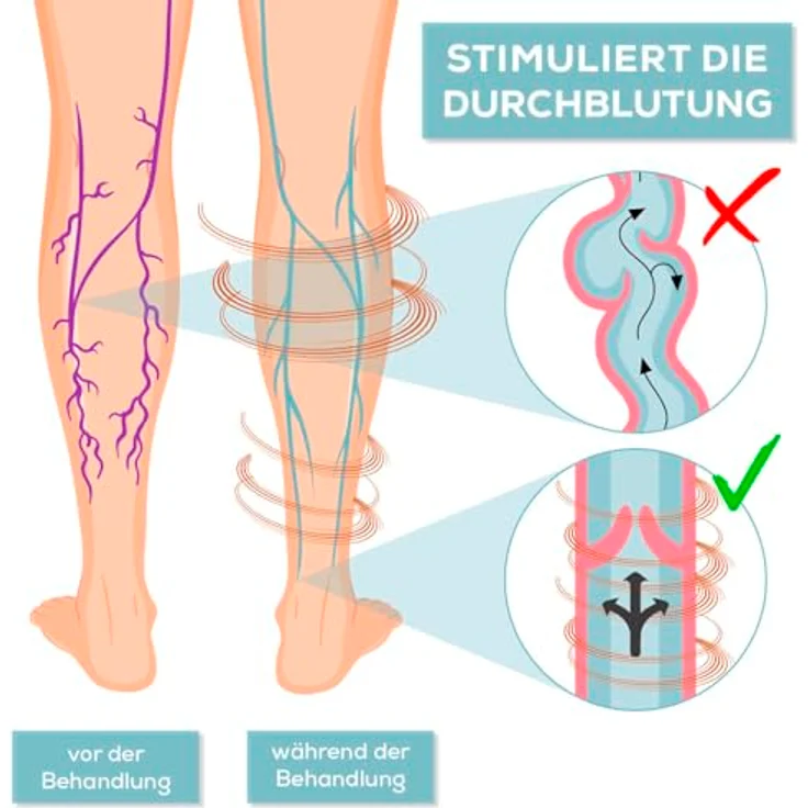 VenenWalker Venentrainer Durchblutungs-Stimulator + Fernbedienung 4 Pads EMS, leicht und tragbar, inklusive EMS-Elektroden, weiß – Bild 3
