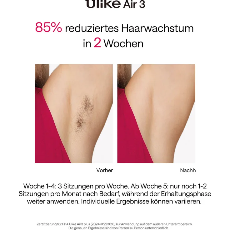 Ulike Air 3 Plus UI06 PP, Epilierer mit Sapphire® Ice Cooling Technologie, rosa