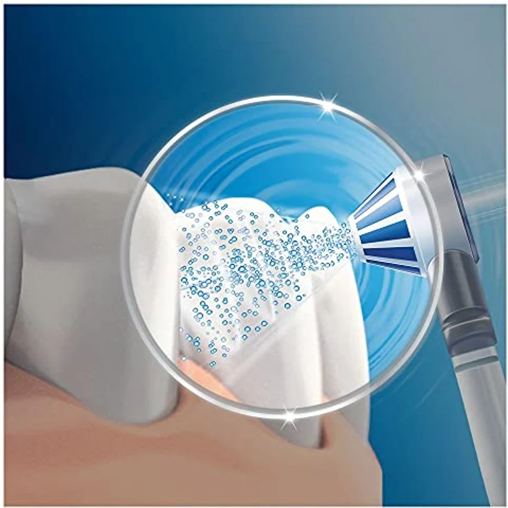 Oral-B OxyJet Ersatzdüsen für Munddusche/Zahnzwischenraumreiniger, 4 Stück, für gezielte Zahnreinigung mit Mikro-Luftblasen-Technologie – Bild 2