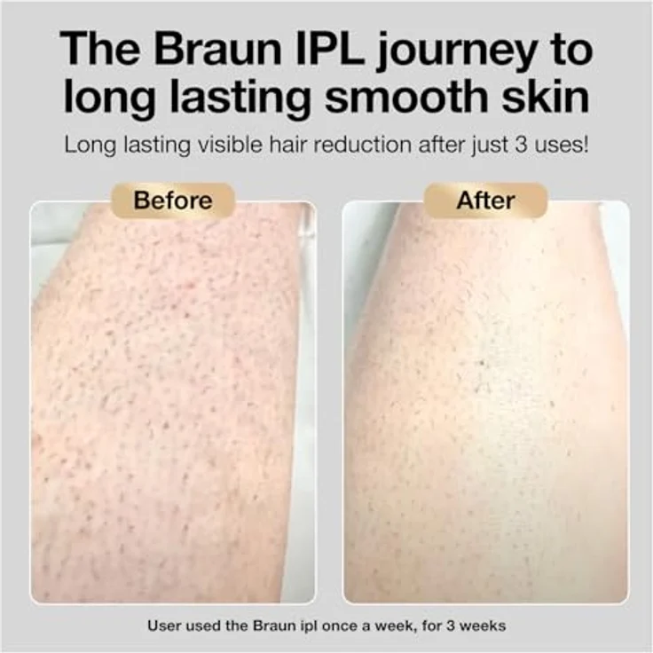 Braun, IPL Gerät, Silk·expert Pro 5 PL5147 – Bild 2