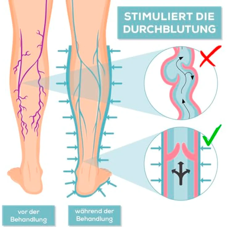 VENENWALKER basic Venentrainer VenenWalker Basic, Set 5-tlg., 1* Steuergerät, 1* Tragetasche, 2* Beinmanschetten, 1*Netzadapter, Massagegeräte mit Wechseldrucktechnik, für müde und geschwollene Beine, blau – Bild 4