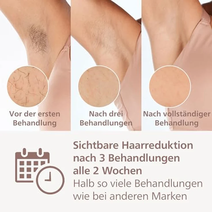 Philips Lumea 8000 Series, IPL-Haarentfernungsgerät, SenseIQ Technologie, 3 Aufsätze, BRI946/00 – Bild 3