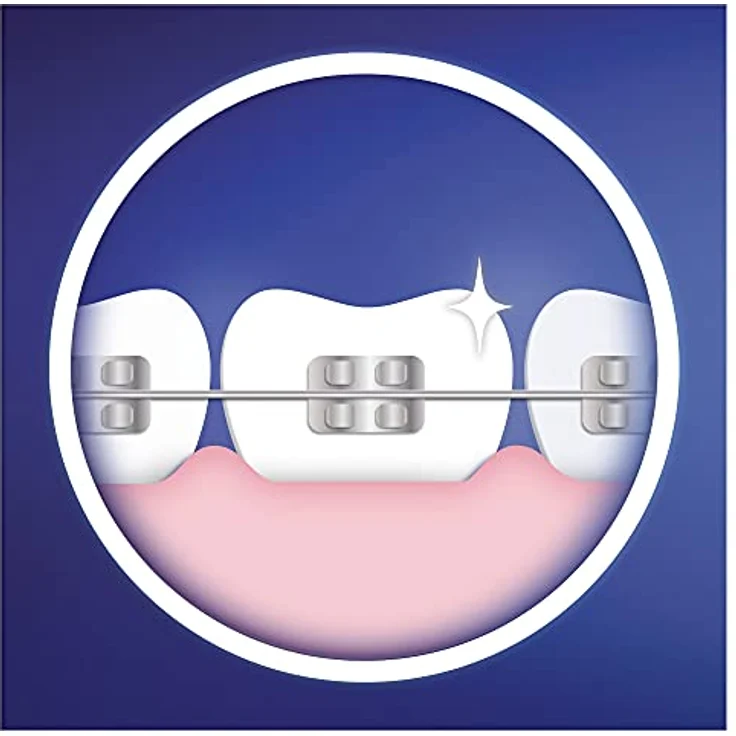 Oral-B Ortho Care Essentials Aufsteckbürsten für elektrische Zahnbürste, für Zahnspangen, mit extra Interspace Aufsteckbürste, Zahnbürstenaufsatz für Oral-B Zahnbürsten , 3 Stück (1er Pack) – Bild 5