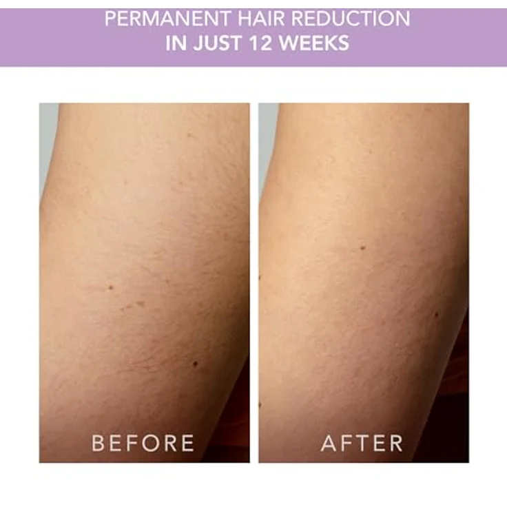 Foreo PEACH 2 go IPL Haarentfernungsgerät Lavender Dauerhafte Haarentfernung auf Reisen Laser-Haarentfernung Körper und Gesicht Schnell Schmerzfrei Kühlung und Silikonhülle – Bild 5