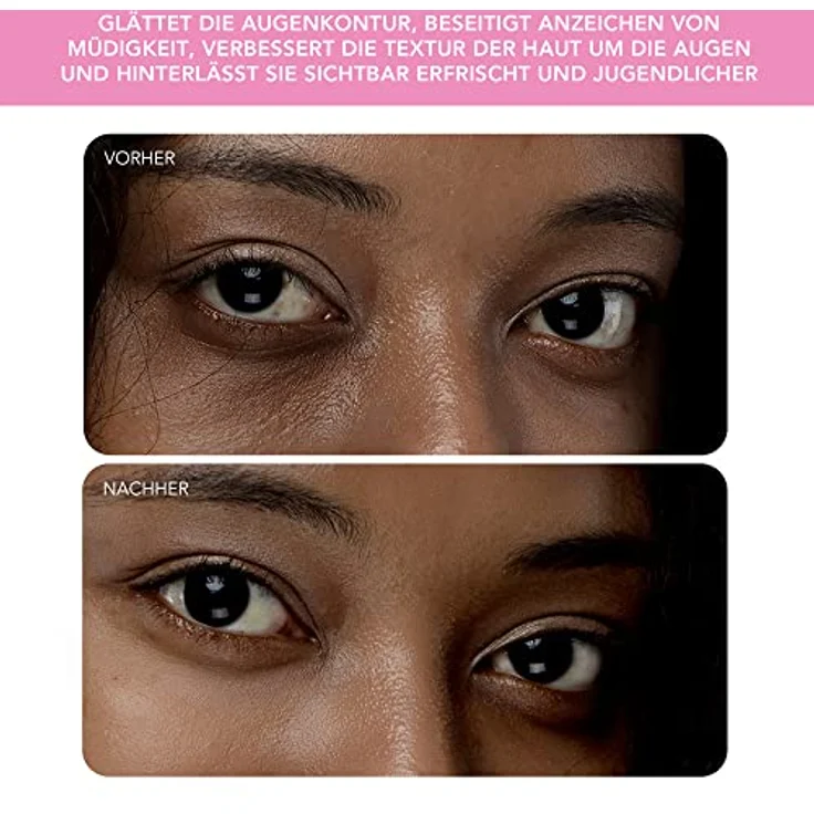 FOREO Massagegerät IRIS™ 2, für die Augenpartie mit T-Sonic™ Technologie und 2 Massage Modi – Bild 5