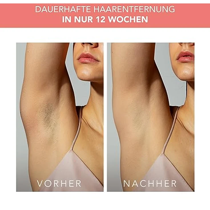 FOREO PEACH 2 IPL-Gerät zur Haarentfernung - Alternative zur Laser-Haarentfernung und Epilierern für Damen - Dauerhafte Haarentfernung für Körper & Gesicht - 10-Minuten-Behandlung - Kabelgebunden – Bild 5