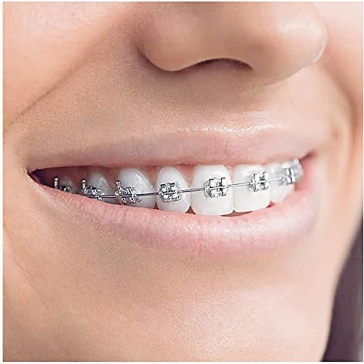 Oral-B Ortho Care Essentials Aufsteckbürsten für elektrische Zahnbürste, für Zahnspangen, mit extra Interspace Aufsteckbürste, Zahnbürstenaufsatz für Oral-B Zahnbürsten , 3 Stück (1er Pack) – Bild 3