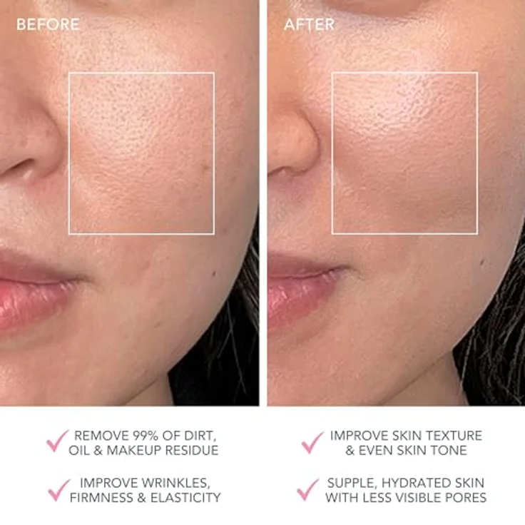 FOREO Elektrische Gesichtsreinigungsbürste LUNA™ 4 plus normal skin, 4-in-1 Gesichtsreinigungsgerät mit T-Sonic™ Pulsationen, NIR und rotem LED-Licht - Blau – Bild 5