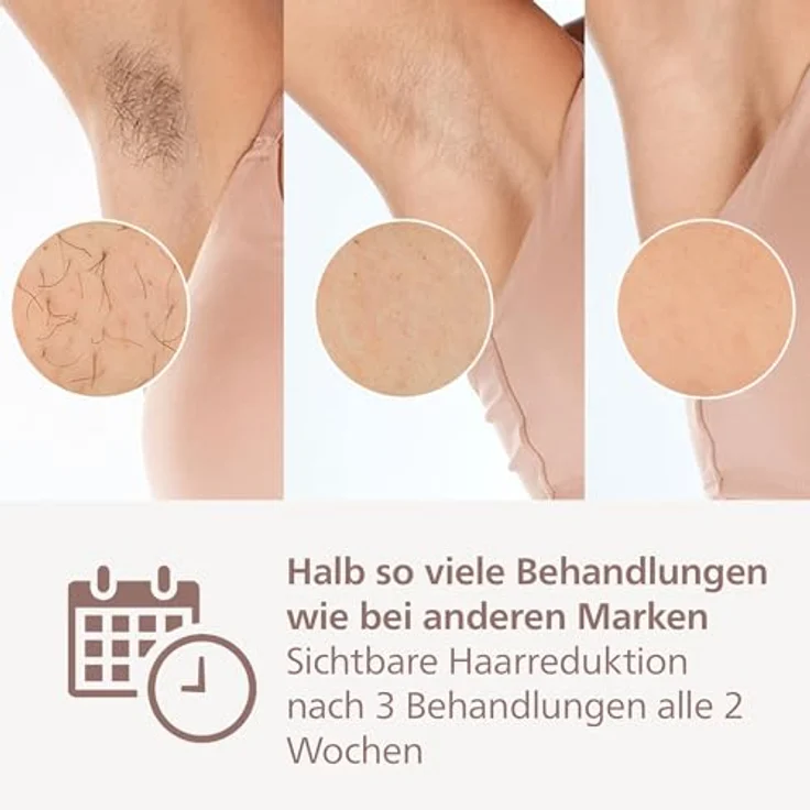 PHILIPS Philips Lumea 9900 Series, IPL-Haarentfernungsgerät, Alternative zur Laserhaarentfernung, SenseIQ und SkinAI, 3 Aufsätze für Körper, Gesicht und Präzisionsbereiche, Akku- und Netzbetrieb, BRI953/02 – Bild 3