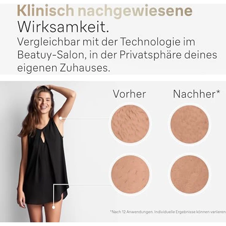 Braun IPL Silk·expert Pro 5, Haarentfernung für zuhause, Alternative zur Laser-Haarentfernung, Weiß und Gold – Bild 3