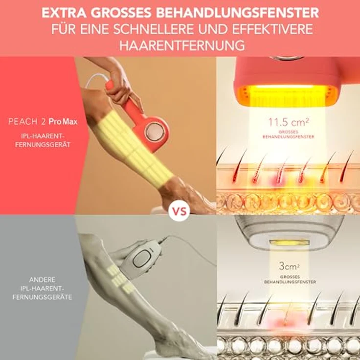 FOREO PEACH 2 Pro Max IPL Haarentfernungsgerät – Fortschrittlicher Epilierer mit 5 Intensitätsstufen, Silikonschild und 360° Hautkühlung für glatte Haut an Gesicht & Körper – Bild 3