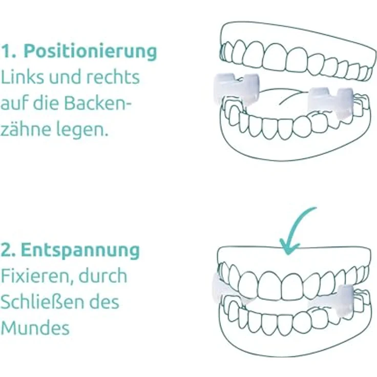TJ-MOTION be in balance TJ-Motion Aligner, Sanfte Kieferdehnung für ganzheitliche Entspannung, 5,5 mm Bisshöhe, 2er Pack, medizinisches Silikon – Bild 7