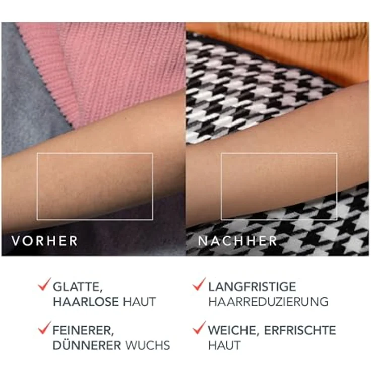 FOREO PEACH 2 Pro Max IPL Haarentfernungsgerät – Fortschrittlicher Epilierer mit 5 Intensitätsstufen, Silikonschild und 360° Hautkühlung für glatte Haut an Gesicht & Körper – Bild 5