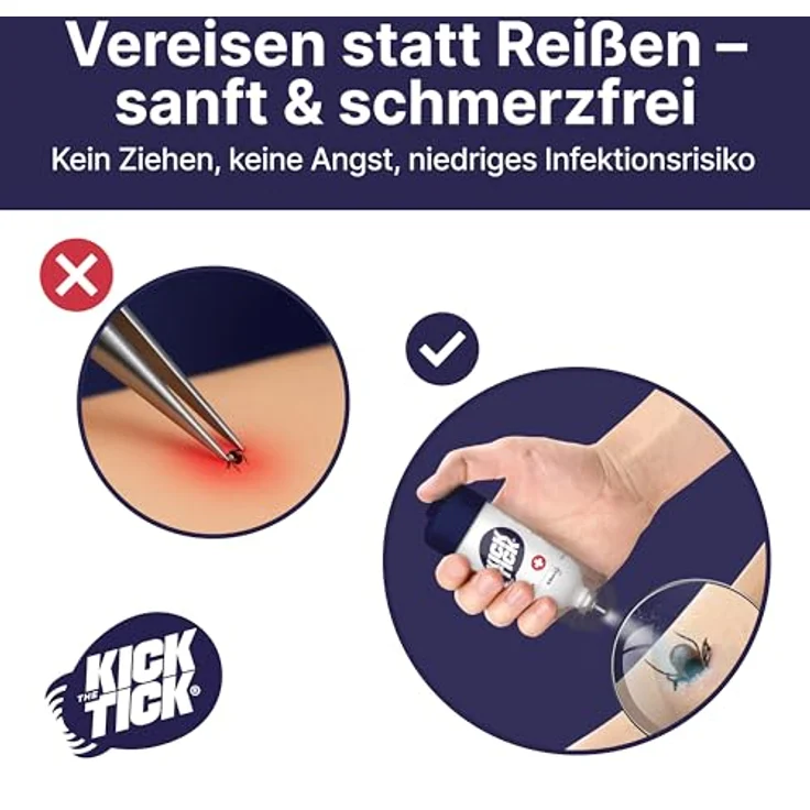 Novokill KICK THE TICK Vereisungsspray mit Zeckenzange – Schmerzfreier Zeckenentferner für Mensch, Kind, Hund & Katze – Über 40 Anwendungen – Bild 3